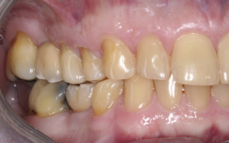 After treatment