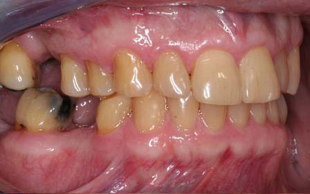 Before treatment
