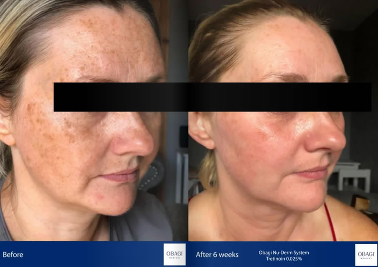 Obagi skin care
