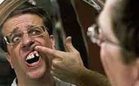 How important are teeth?